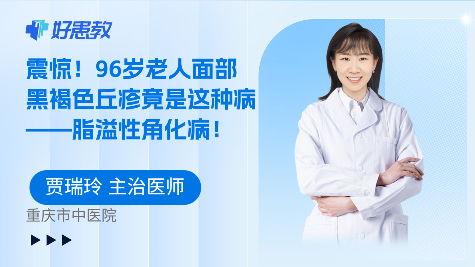震惊！96岁老人面部黑褐色丘疹竟是这种病——脂溢性角化病！