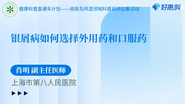 银屑病如何选择外用药和口服药