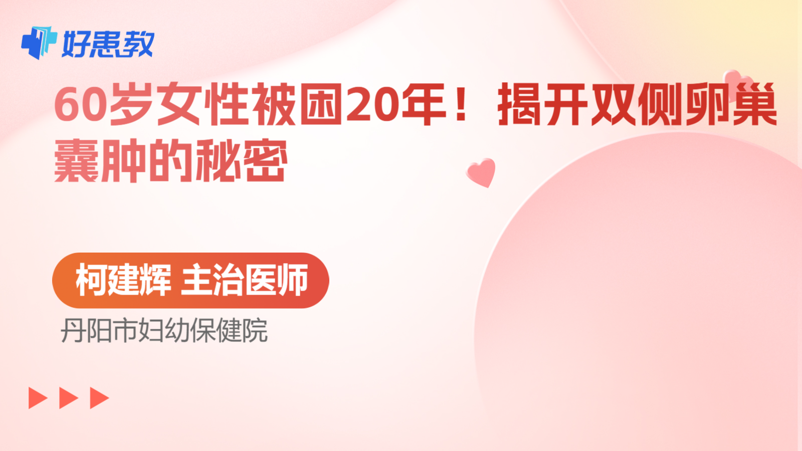 科普，60岁女性被困<span style="color: #da4707">20</span>年！揭开双侧卵巢囊肿的秘密