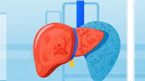 了解肝癌临床分期——及早发现，科学预防