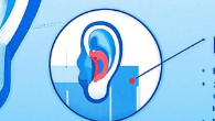 科普，耳朵的小秘密：揭开<span style="color: #da4707">耳廓</span>假性囊肿的神秘面纱
