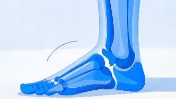 足部腱鞘囊肿手术麻醉选择：保障安全与舒适的关键