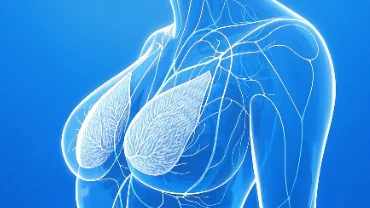 乳腺癌二期:了解、治疗与预防