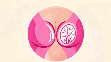 熬夜与乳腺癌风险：你需要知道的惊人真相！封面图