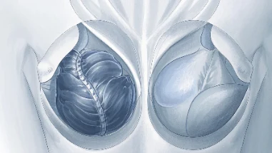 乳腺癌早期诊断与预防——关爱你的健康,从预防开始!