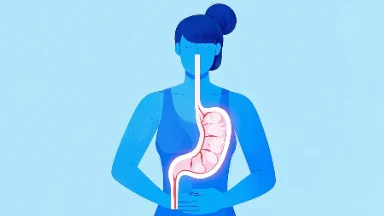 贲门癌的预防与治疗——揭示神秘的食管连接点疾病