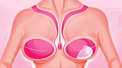 神奇的乳腺癌战斗故事—让我们一起对抗癌魔!