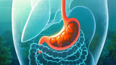 胃癌三期患者该怎么办?!科学应对胃癌的详细指南