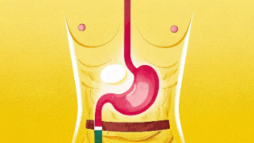 胃癌<span style="color: #da4707">一期</span>：早发现，早治疗，健康放心上