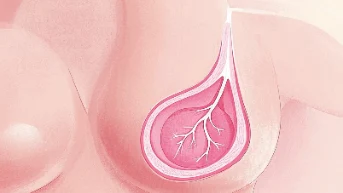 防患于未然:了解并预防乳腺癌的发生!