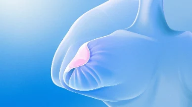 乳腺癌防治攻略——远离三期乳腺癌的威胁！