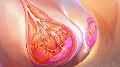 早期乳腺癌的科学管理与治疗全解析