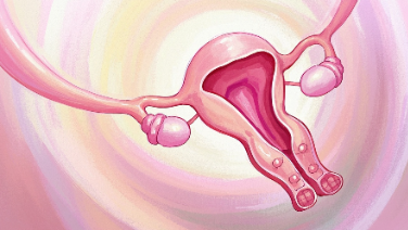 科普，子宫<span style="color: #da4707">肌瘤</span>：全面解析与管理指南