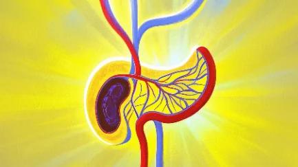 急性胰腺炎:全面解析及管理建议