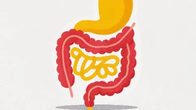 从肠癌案例看——癌症防治,我们能做些什么?