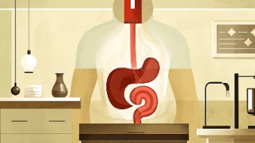 如何科学管理晚期食管腺癌?详细讲解从诊断到治疗