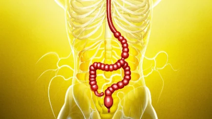 50岁男性结肠息肉:不可忽略的健康警钟!