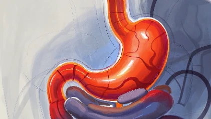 老年人胃黏膜病变的风险与预防策略