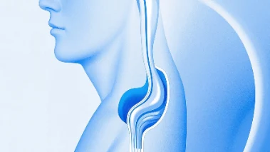 食道癌：从诊断到管理的全面指南