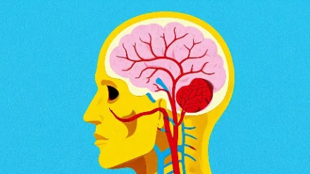 颅内占位性病变的警示信号与应对方法