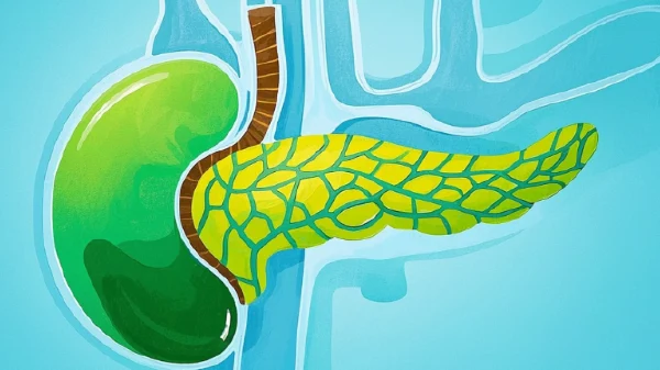 胰腺占位性病变与梗阻性黄疸:从精准诊断到科学治疗