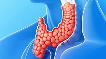 右侧甲状腺恶性肿瘤:全面解析与治疗指南