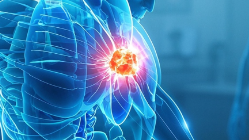 科普，<span style="color: #da4707">多发性骨髓瘤</span>：科学认知与实用<span style="color: #da4707">应对</span>