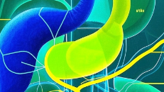 科普，胆囊<span style="color: #da4707">病变</span>：<span style="color: #da4707">小</span>症状大警报，必要检查与治疗指南