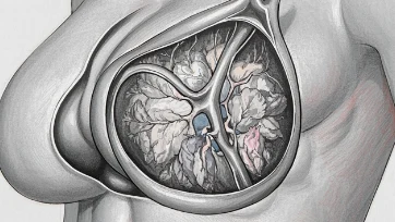 探索左侧乳腺恶性肿瘤 IIB期的治疗与预后:勇敢面对未知的旅程