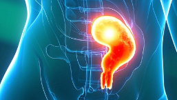 科普，卵巢恶性肿瘤：全面了解这一<span style="color: #da4707">疾病</span>的关键<span style="color: #da4707">知识</span>