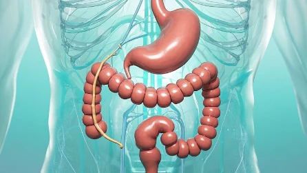 什么是乙状结肠腺癌?