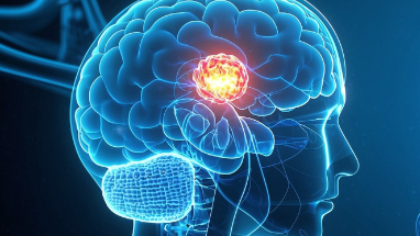 科普，了解<span style="color: #da4707">脑</span>恶性肿瘤：掌握关键<span style="color: #da4707">知识</span>，保护<span style="color: #da4707">健康</span>