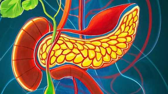 胰腺癌的科学认知与治疗策略解析