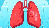 科普，什么是中央<span style="color: #da4707">型</span>肺癌？