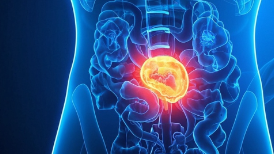 科普，<span style="color: #da4707">直肠癌</span>：识别、<span style="color: #da4707">诊断</span>及管理的全面<span style="color: #da4707">指南</span>