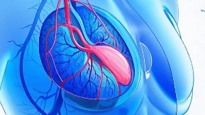 四期乳腺癌患者的化疗与副作用管理
