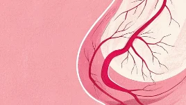 乳腺癌III期:挑战与希望的旅程