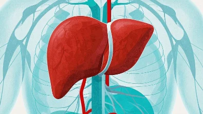 护肝指南:早期识别肝癌症状与预防措施