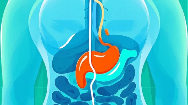 全面解读胆囊息肉、肺结节及肝囊肿：多系统疾病的诊断与管理