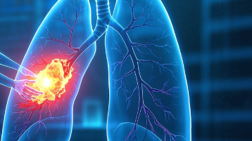 科普，肺恶性肿瘤的科学认识与应对封面图