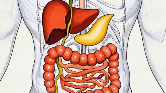 腹股沟疝的全面解析:病因、诊断与治疗