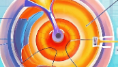 科普，突破视野的边界：<span style="color: #da4707">黄斑</span>变性的治疗新进展