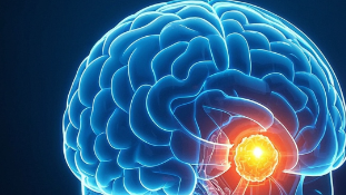 科普，脑恶性<span style="color: #da4707">肿瘤</span>科普指南：如何识别、应对与守护<span style="color: #da4707">大脑</span>健康 🧠