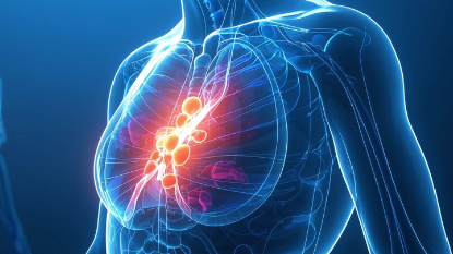 科普，乳腺癌：科学认识和有效应对的指南封面图