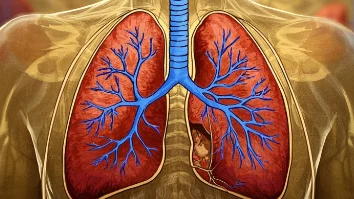 慢性阻塞性肺疾病:家庭必知的健康知识与预防措施