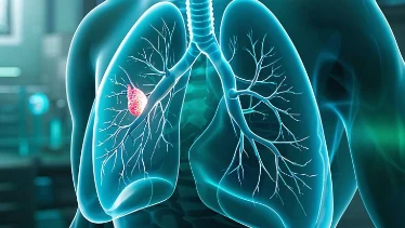 肺炎早期信号详解：如何科学防控？