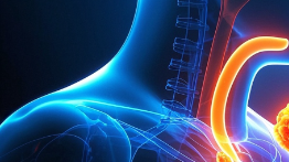 科普，深入了解食管恶性肿瘤：识别、诊断与管理封面图