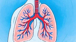 支气管炎治疗药物指南:缓解症状与预防秘笈