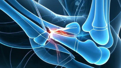 骨骼健康需重视：探讨股骨颈骨折及其预防与治疗！