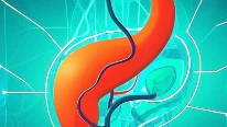 胆道疾病手术麻醉方案选择与注意事项